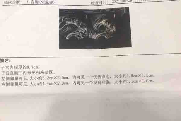 供卵试管婴儿有影响吗-供卵试管婴儿对孩子有什么影响