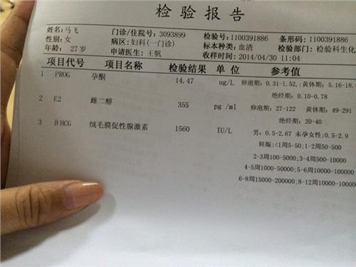 张庭女儿的长相被吐槽!供卵试管婴儿会不会是基因突变？看看孩子的长相遗传规律吧