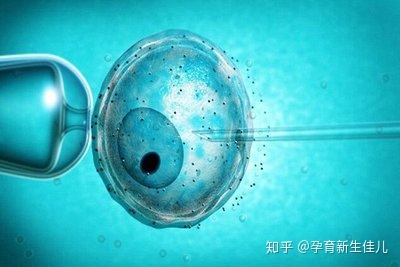 供卵试管哪里代怀过程供卵自怀机构的具体过程