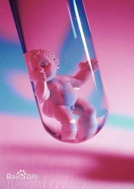 没有人照顾，我可以自己做赠卵试管自怀吗？