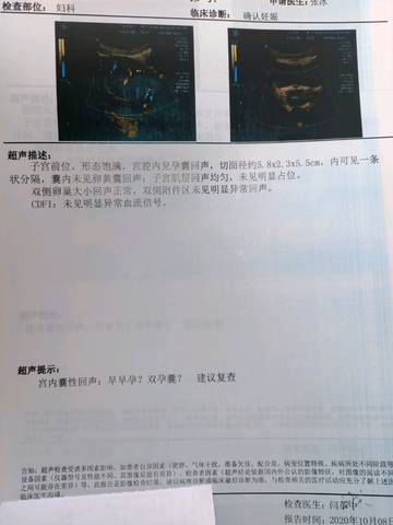 在单亲家庭长大的山东30岁美女坚持不结婚，通过做供卵试管三代代生生下混血三胞胎
