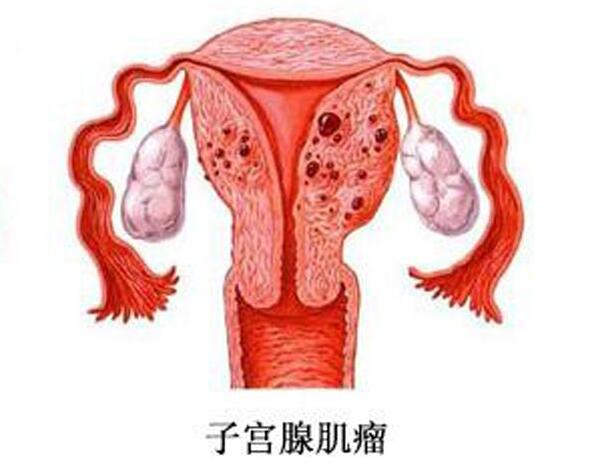 借卵试管月经期间做的免疫全套是查什么项目