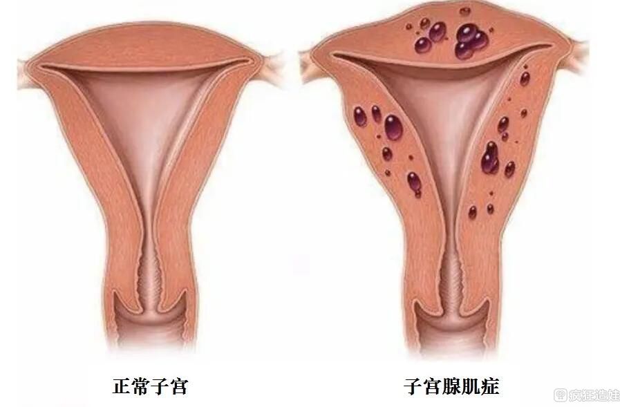 试管婴儿成功取决于什么