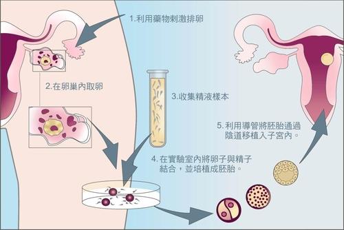 女方胖做试管婴儿成功率怎么样