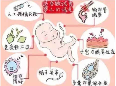 哈尔滨试管婴儿二代费用高吗