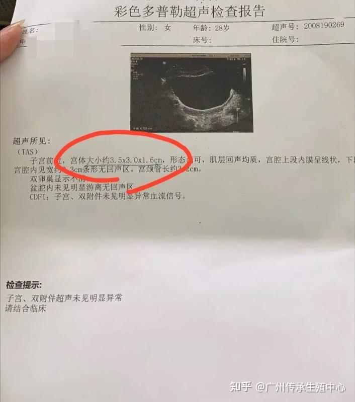 动用精子库什么意思