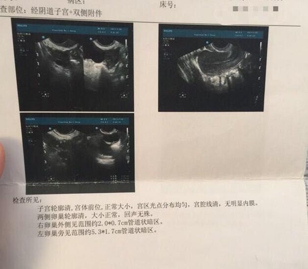 生子代生试管赛增怎么打打在什么部位比较合适