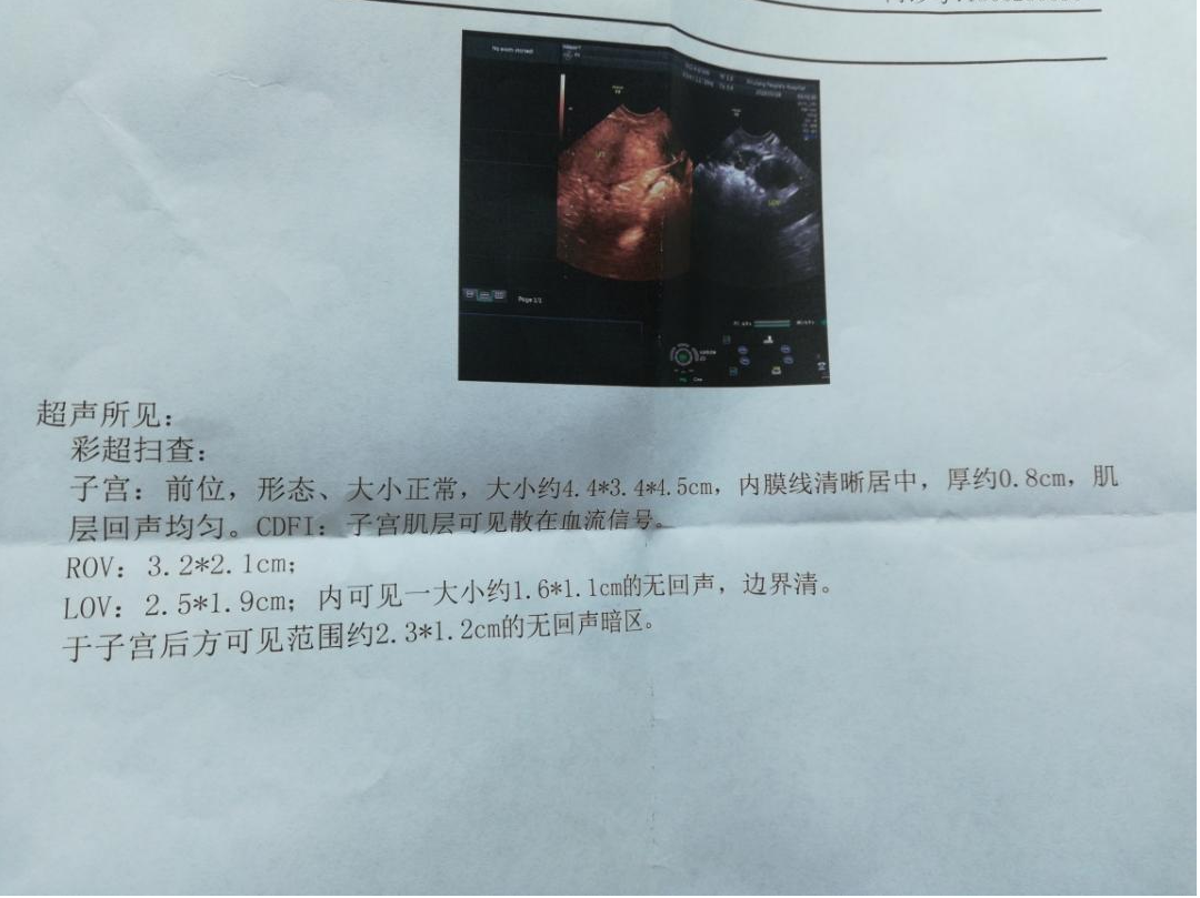 哈尔滨哪家医院第三代年龄45岁试管代怀好（2次试管失败准备换家医院!）