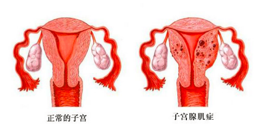 哈尔滨哪家医院第三代年龄45岁试管代怀好（2次试管失败准备换家医院!）