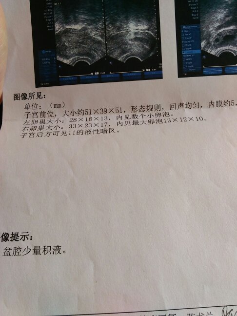 试管怀孕几个月稳定