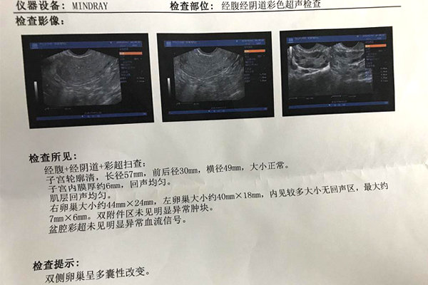 卵巢早衰吃补佳乐有效果吗