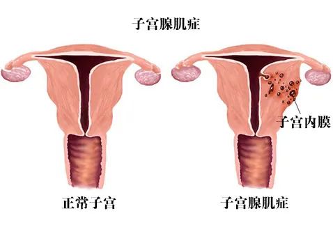 「患血友病在哈尔滨做代怀可以生女孩吗」哈尔滨大学第二附属医院代怀哪家好婴儿吗（附医院试管花费明细!）