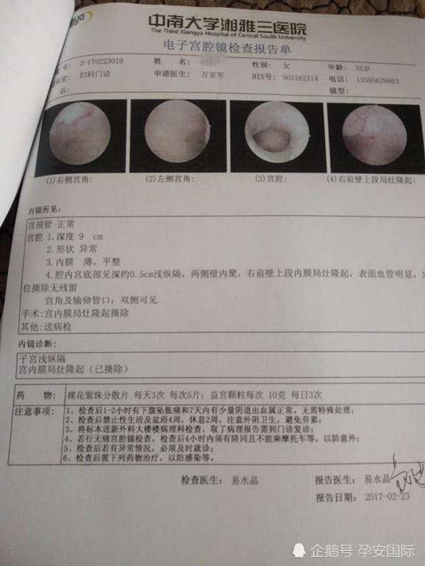 哈尔滨试管代生助孕机构性别选择女性不孕不育的症状